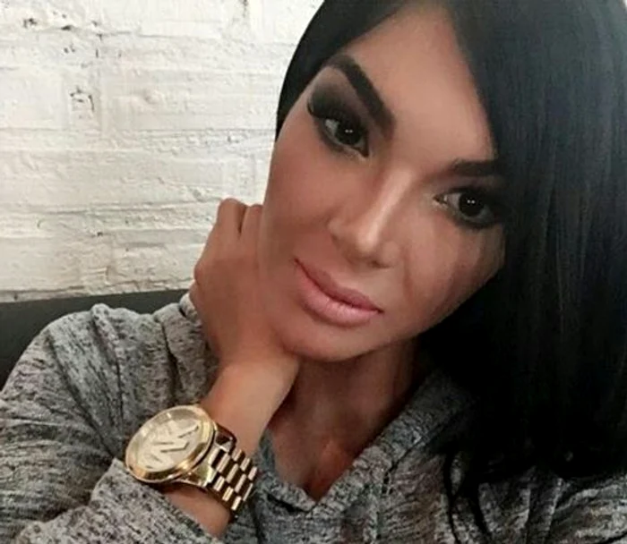 Aleira este tare mândră de rezultatul operațiilor esteticeFoto: Instagram