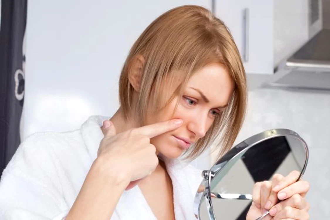 Coşuri pe maxilar şi pe gât = hormonii o iau raznawww.clickpentrufemei.ro