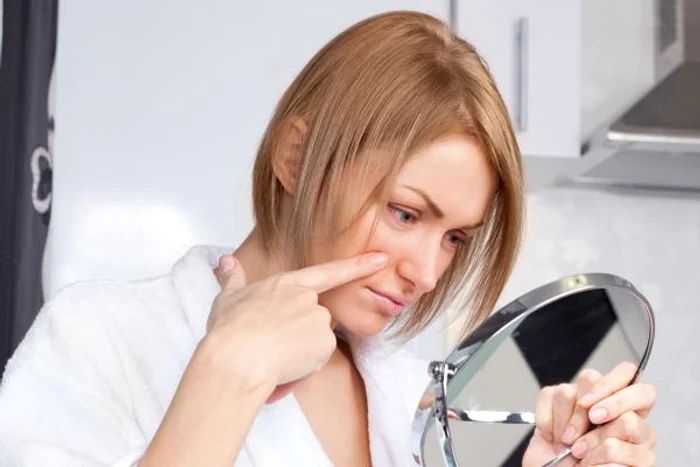 Coşuri pe maxilar şi pe gât = hormonii o iau raznawww.clickpentrufemei.ro