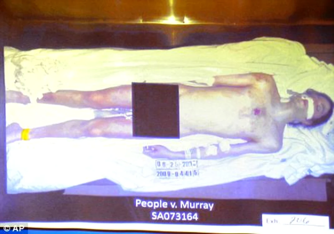 Cadavrul lui Michael Jackson (foto Daily Mail)