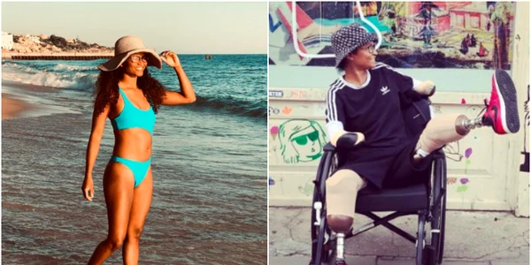 O dansatoare a rămas fără mâini și picioare după ce a fost mușcată de un țânțar în vacanță FOTO Instagram 