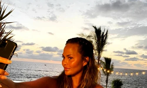 1 chrissy botox jpg jpeg