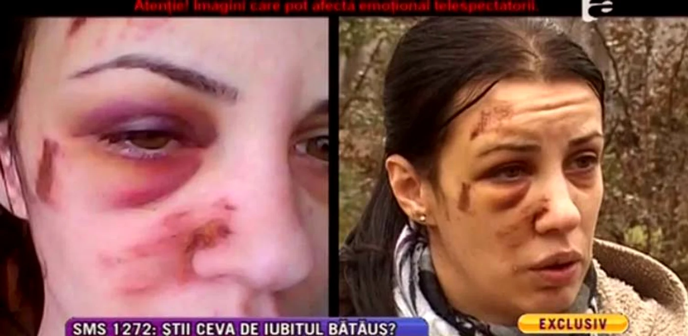Ultima bătaie primită a desfigurat-o pe Alexandra