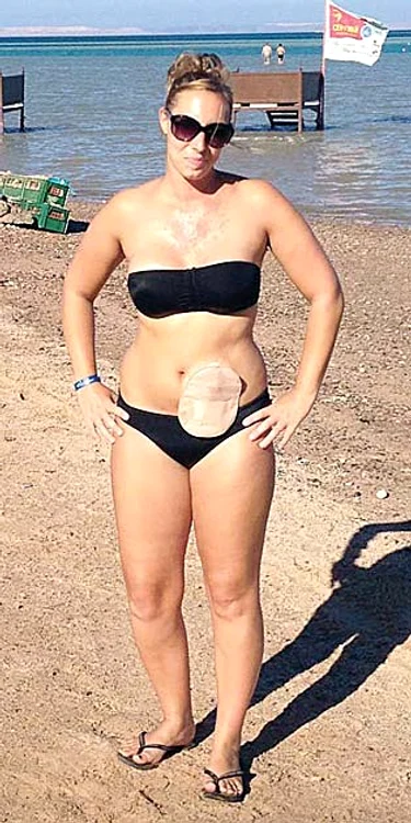 Nicola Woodman (26 de ani)Foto: Photoland/Caters