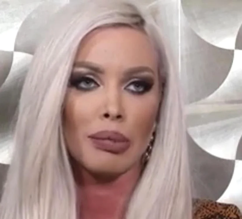 Aşa arată Loredana Chivu după ce şi-a mărit buzele foto: captură video
