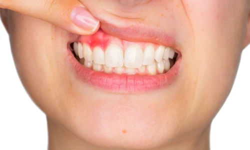 1 shutterstock 616331219 jpg jpeg