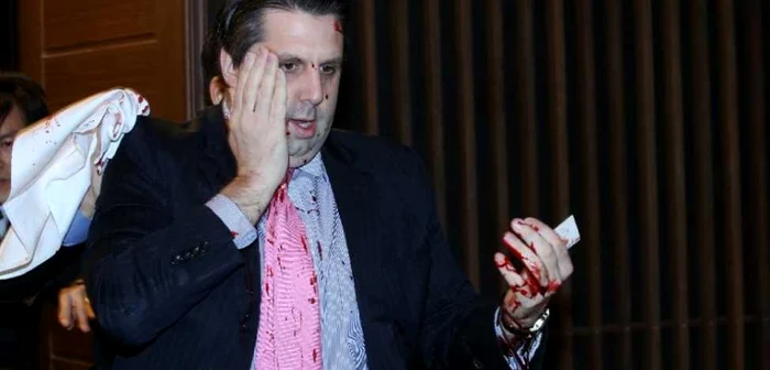 Ambasadorul american Mark Lippert, rănit joi la Seul FOTO AFP