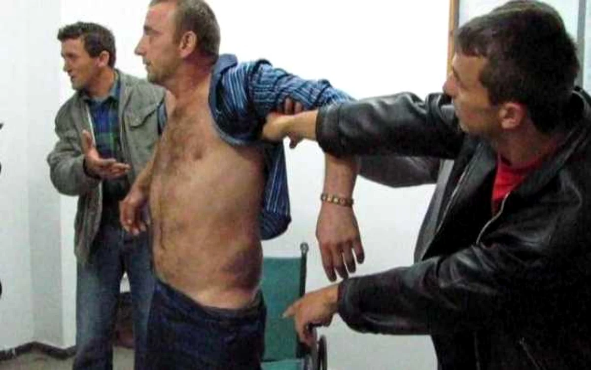 Bărbatul rămâne în spital sub observaţie medicală