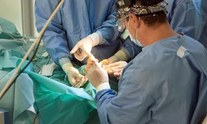 deget 1 25639856 jpeg