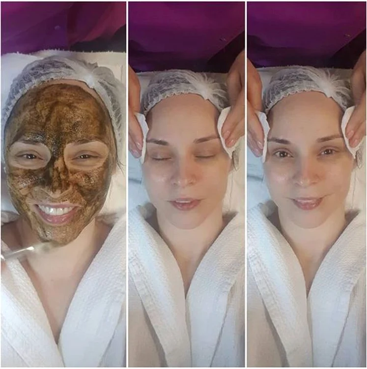 Andreea Marin și-a purificat tenul cu ajutorul unei măști cu scorțișoară și oregano 