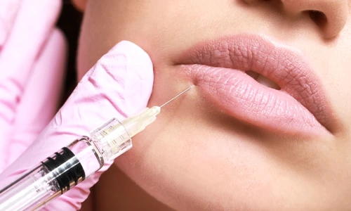 2a85c1f2 04db ae99 8df5 39cfae2b0641 jpg