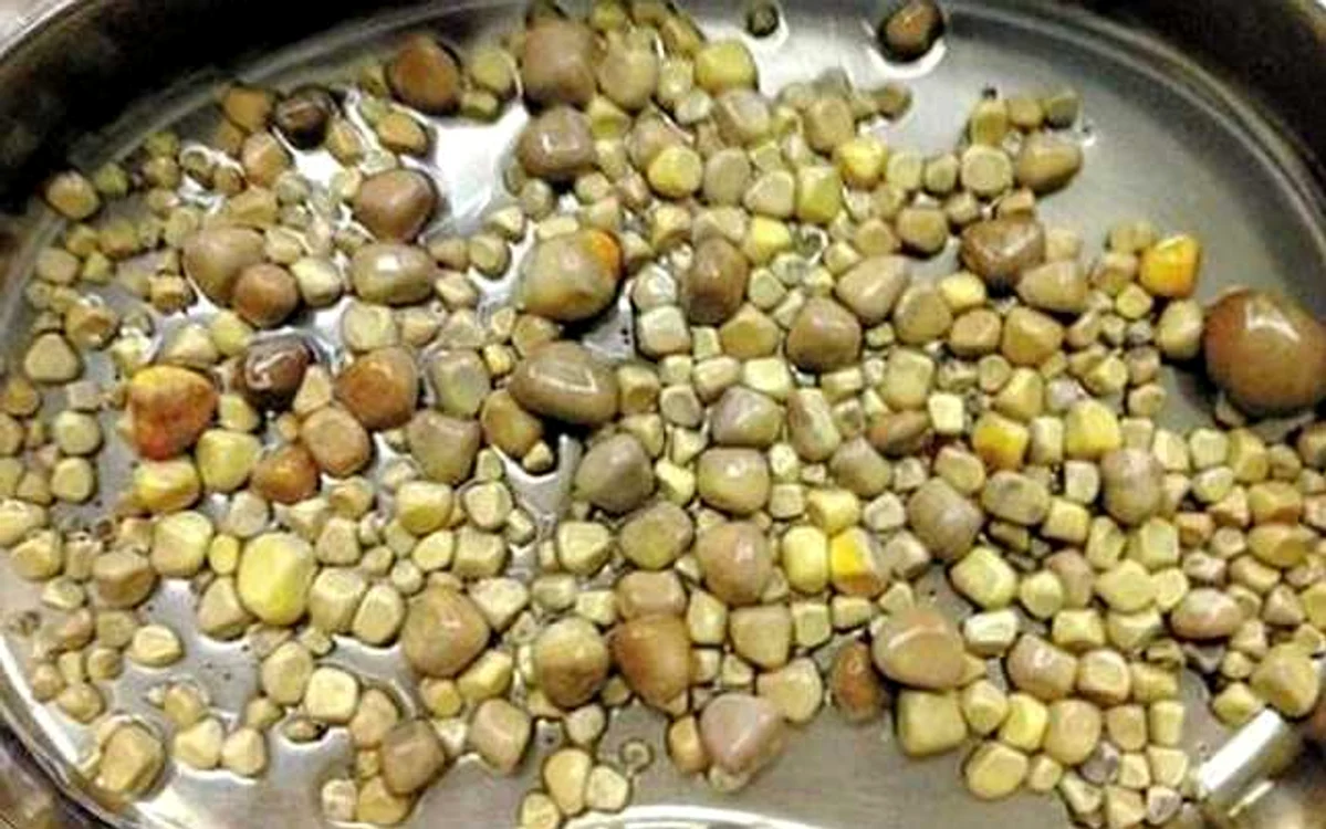 Calculii biliari se formează din cauza colesterolului şi pot avea diverse forme şi dimensiuni FOTO Arhivă