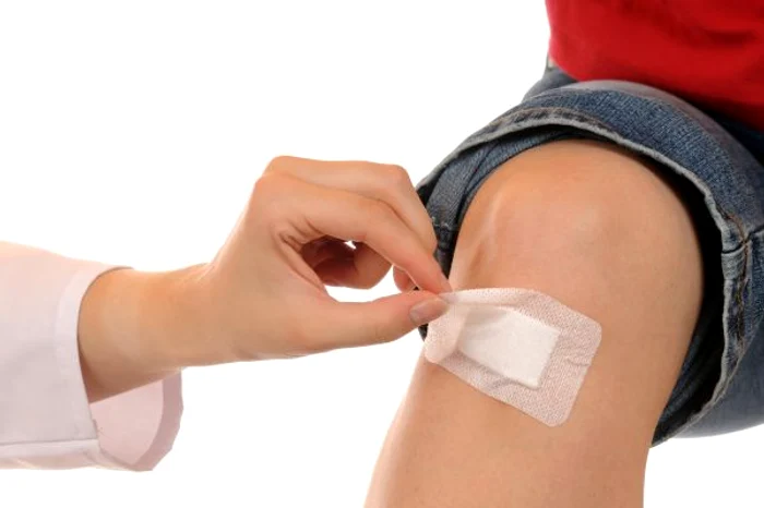 
    Nu aplica creme grase sau unguente deoarece astupă porii și agravează ranaclicksanatate.ro  