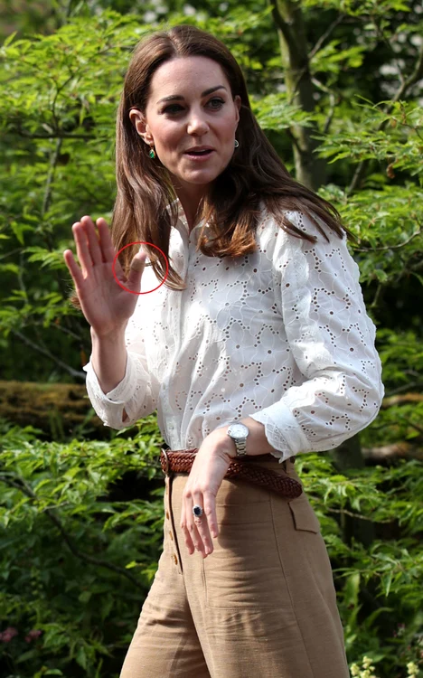Kate Middleton a avut un plasture pe degete și zilele trecute, la Chelsea Flower Show