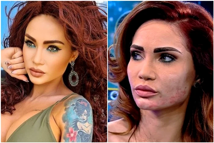 Maria Ilioiu a scăpat de cicatricile de după intervenția esteticăfoto: Instagram