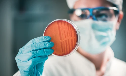 stafilococ auriu jpg