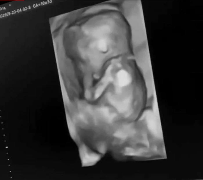 Alina a dezvăluit sarcina prietenilor virtuali