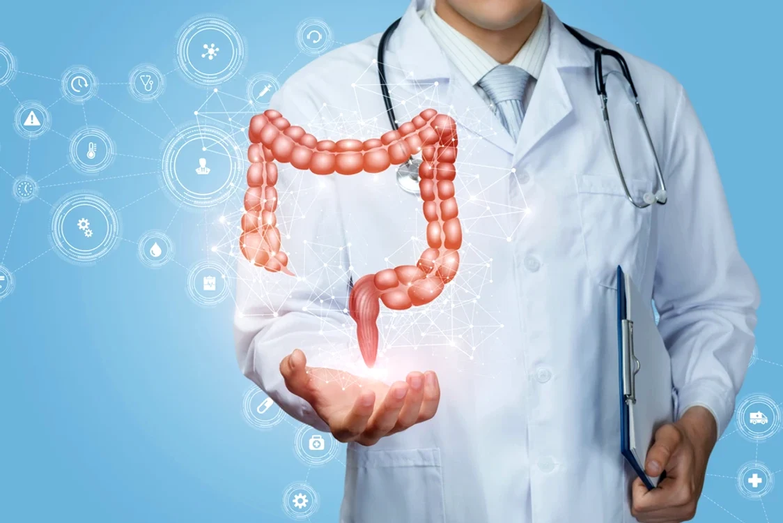 O nouă analiză pentru depistarea cancerului de colon - Foto Arhivă