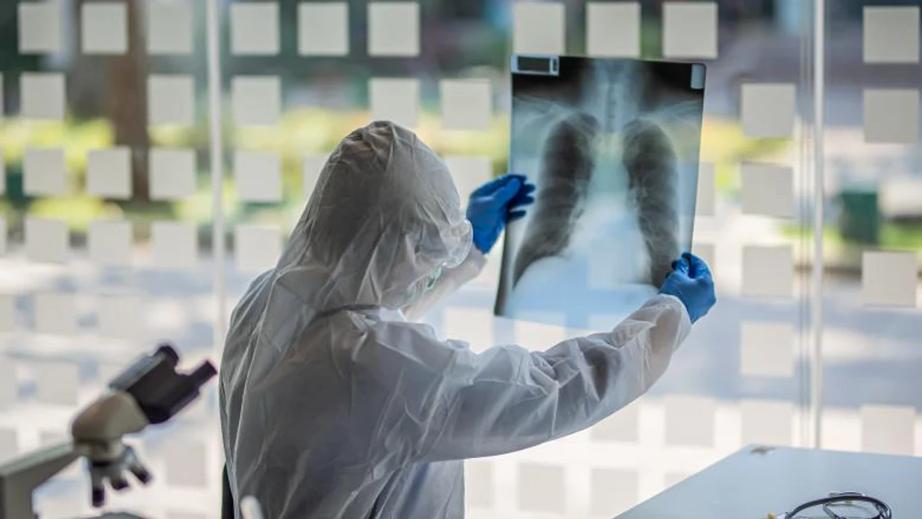 Coronavirusul poate afecta grav plămâniiFoto: Digi24