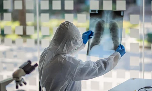 medic care se uita peste o radiografie la plamani jpeg