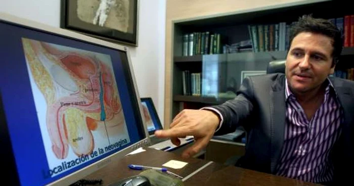 Medicul Ivan Manero, explicând detalii ale operației de schimbare de sex