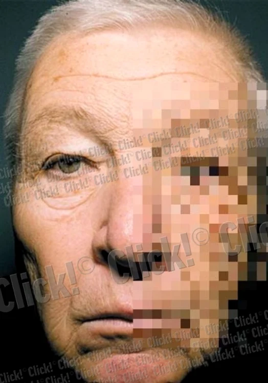 Soarele i-a distrus faţa