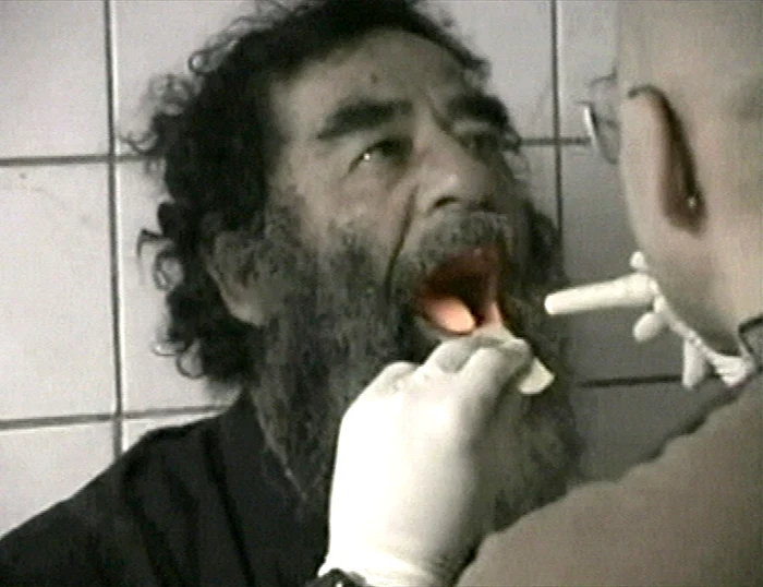 Saddam Hussein, examinat medical după ce a fost găsit de trupele SUA în 2003 FOTO Profimedia