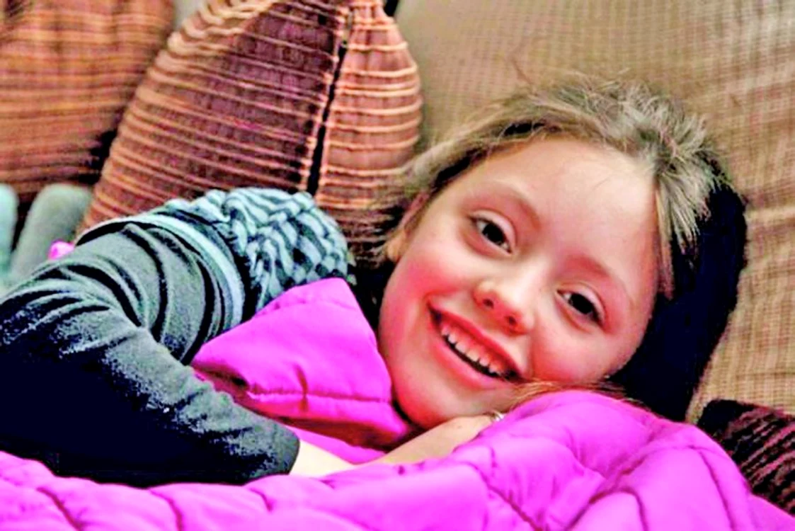 
    Micuţa Angel Burton,  de 8 ani, a şocat întreaga lume  medicală cu povestea ei  