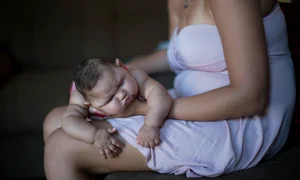 Virusul Zika provoacă microcefalie dacă este contractat în perioada intrauterină jpeg