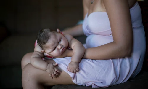 Virusul Zika provoacă microcefalie dacă este contractat în perioada intrauterină jpeg