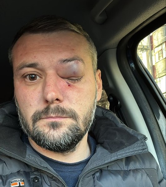 Bătăușul care în primul tur al prezidențialelor l-a agresat pe șeful Serviciului de Pază Olt a fost arestat. A fost găsit după trei săptămâni