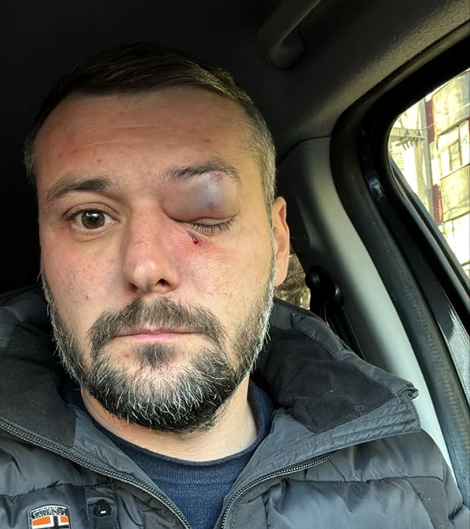 Sabin Bratu, șeful Serviciului de Pază Olt, bătut în ziua votului FOTO: FB/PSD Slatina