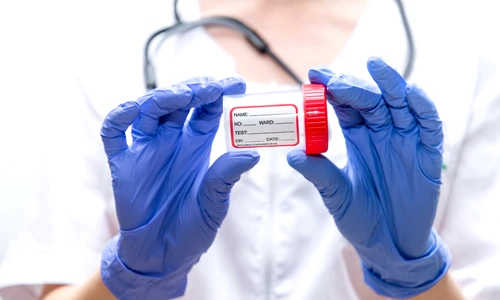 examen coproparazitologic jpg