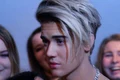 1 boala lyme justin bieber jpg jpeg