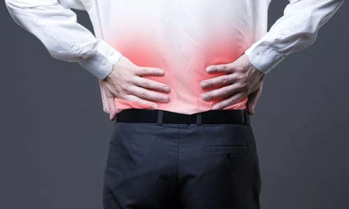 1 calculi renali jpg jpeg