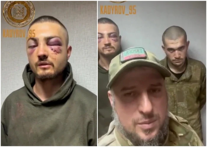 Cecenii lui Kadîrov au capturat un soldat ucrainean care avea ochii învineţiţi:  „A călcat pe o greblă” VIDEO