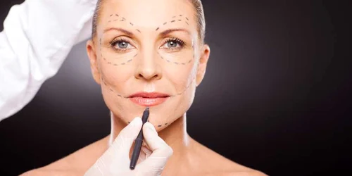 chirurgie estetica lifting facial FOTO shutterstock