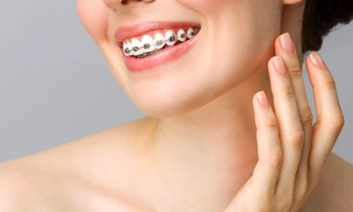 e107232bd159797154e92a1c6c342e615a jpg