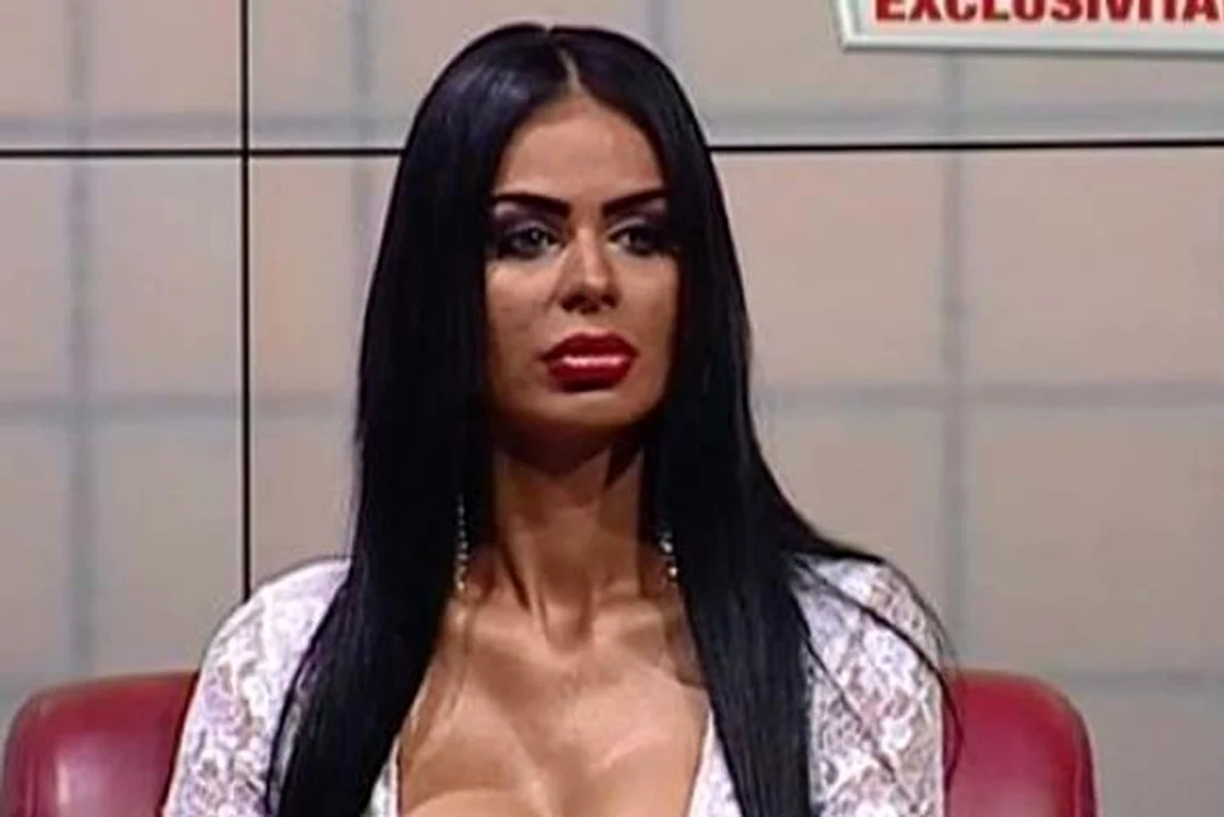 Renata are faţa distrusă. Nici măcar machiajul nu o mai ajută 