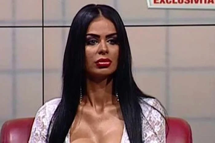 Renata are faţa distrusă. Nici măcar machiajul nu o mai ajută 