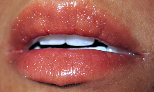 1 72831 original jpg jpeg