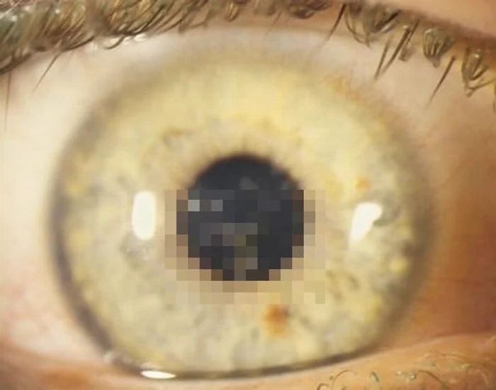 
    Bacteria începe să se dezvolte după aproximativ 20 de zileFoto 9gag.com  