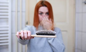 hair loss g45a38c640 1920 jpg