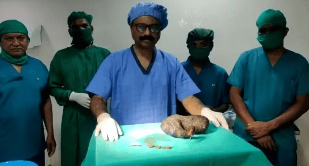 Ce au scos medicii din stomacul unei fete din India, după un obicei pe care-l are de 7 ani