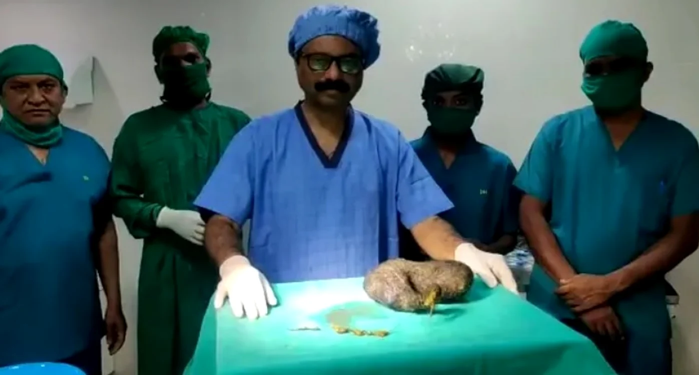 Operația efectuată de medicii indieni a fost un succes Foto: Jam Press/ Australscope