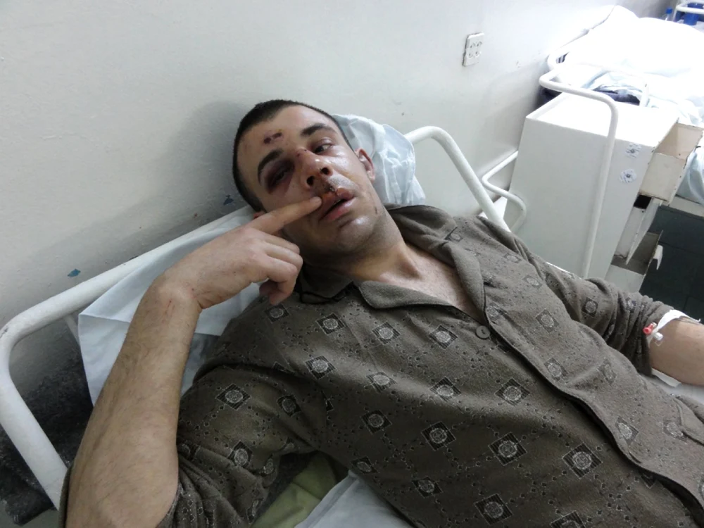Tânărul a ajuns la spital cu faţa tumefiată de pe urma loviturilor încasate... (Foto: Mugurel Manea)
