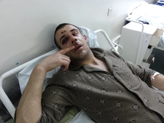 Tânărul a ajuns la spital cu faţa tumefiată de pe urma loviturilor încasate... (Foto: Mugurel Manea)