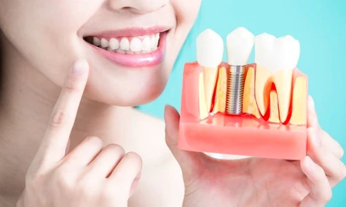 1 shutterstock 644475328 jpg jpeg