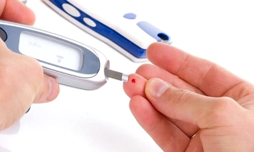 1 72154 original jpg jpeg