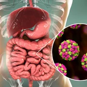 norovirus foto shutterstock